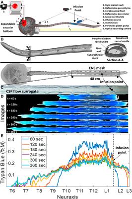 Determination of spinal tracer dispersion after intrathecal injection in a deformable CNS model